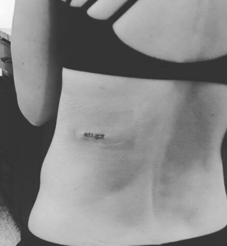 Michelle McCool Skin Cancer Post